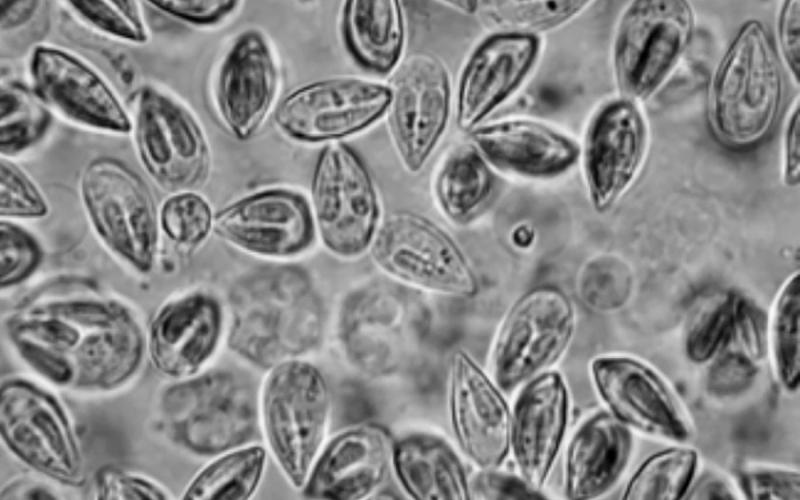 Photomicrograph of myxospores of a Myxobolus sp. from gills of a topminnow, Fundulus. COURTESY PHOTOS